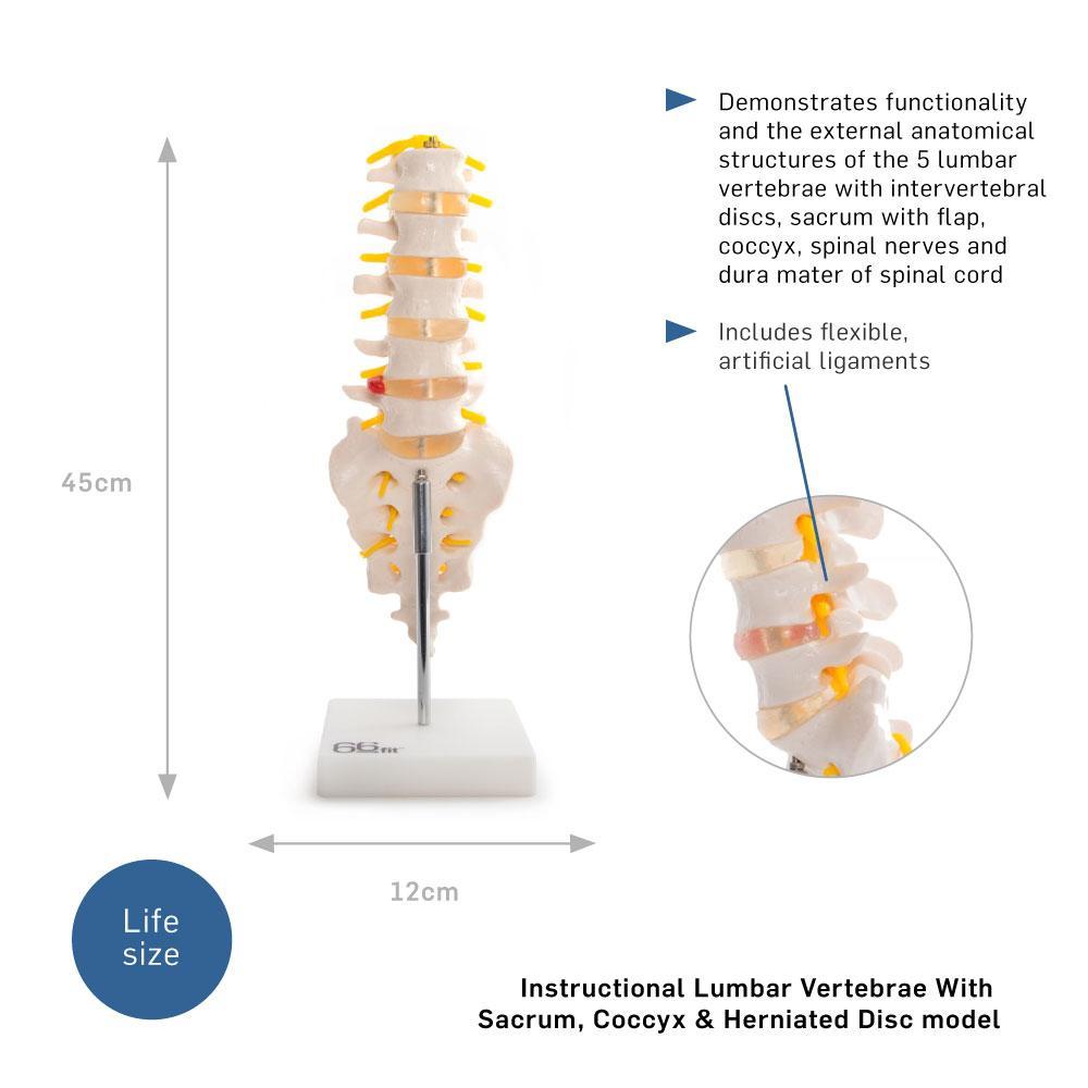 66fit Anatomical Lumbar Vertebrae With Sacrum/Coccyx/Herniated Disc