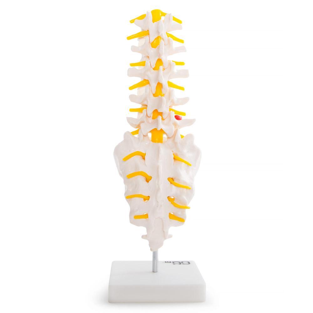 66fit Anatomical Lumbar Vertebrae With Sacrum/Coccyx/Herniated Disc