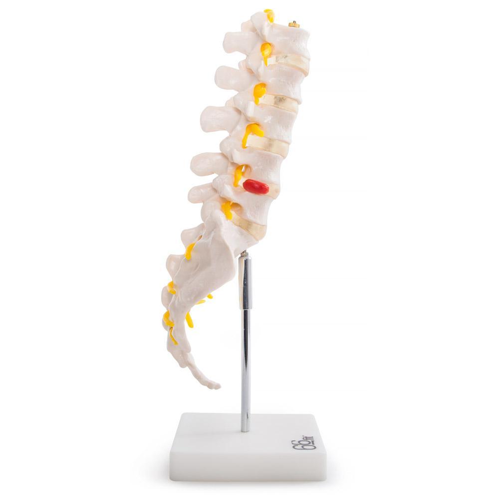 66fit Anatomical Lumbar Vertebrae With Sacrum/Coccyx/Herniated Disc